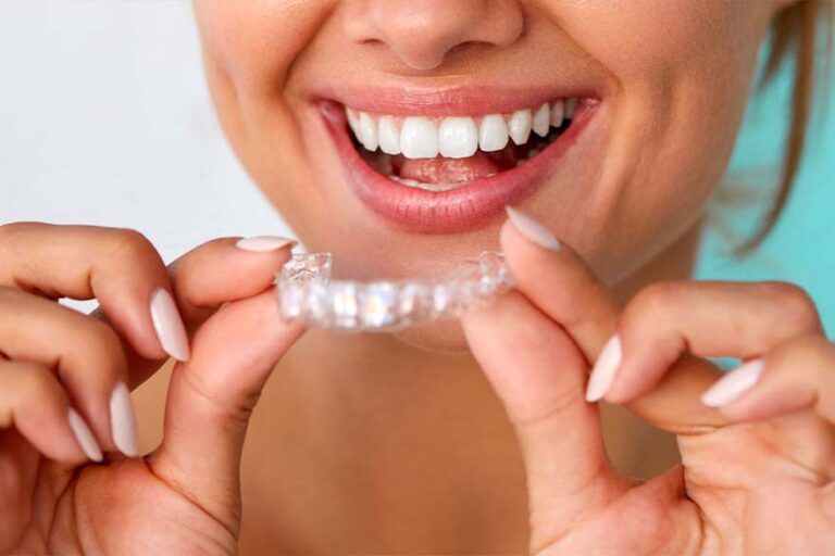 invisalign