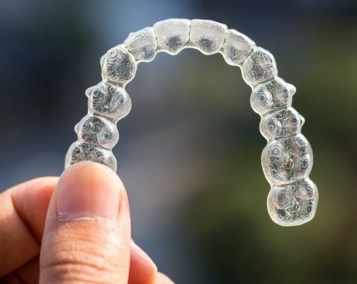 invisalign process 1