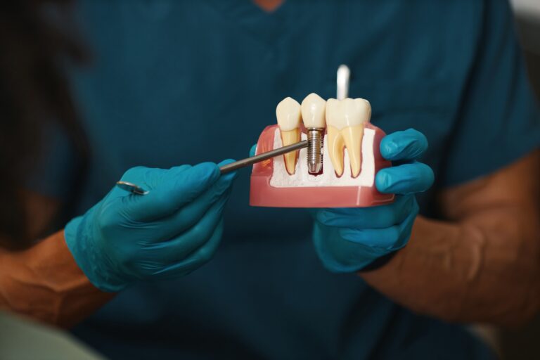 illustrating dental implant procedure on model