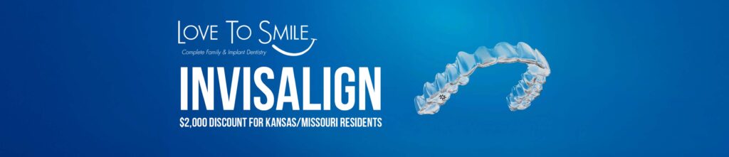 INvisalign banner scaled