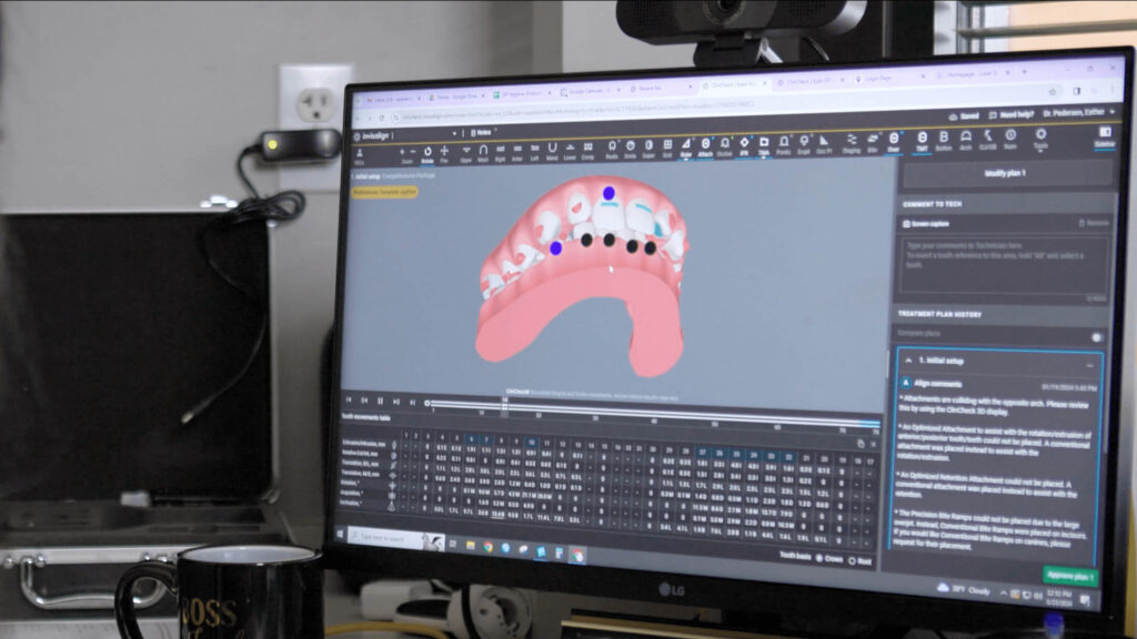invisalign plan