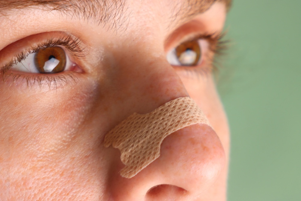 Nasal strip love to smile