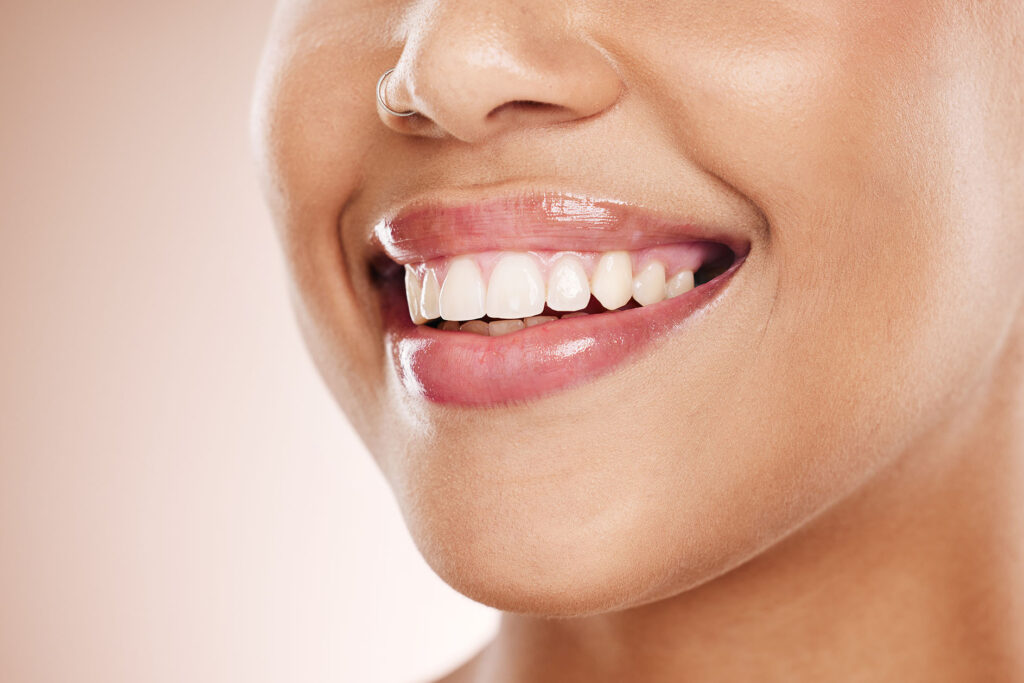 love to smile invisalign teeth