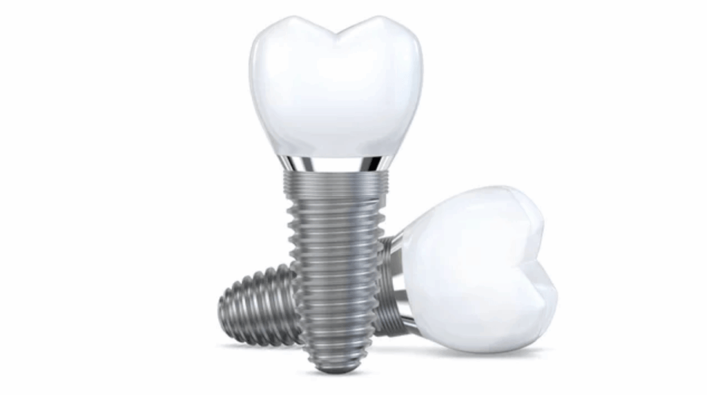 Replace tooth Kansas & Missouri1