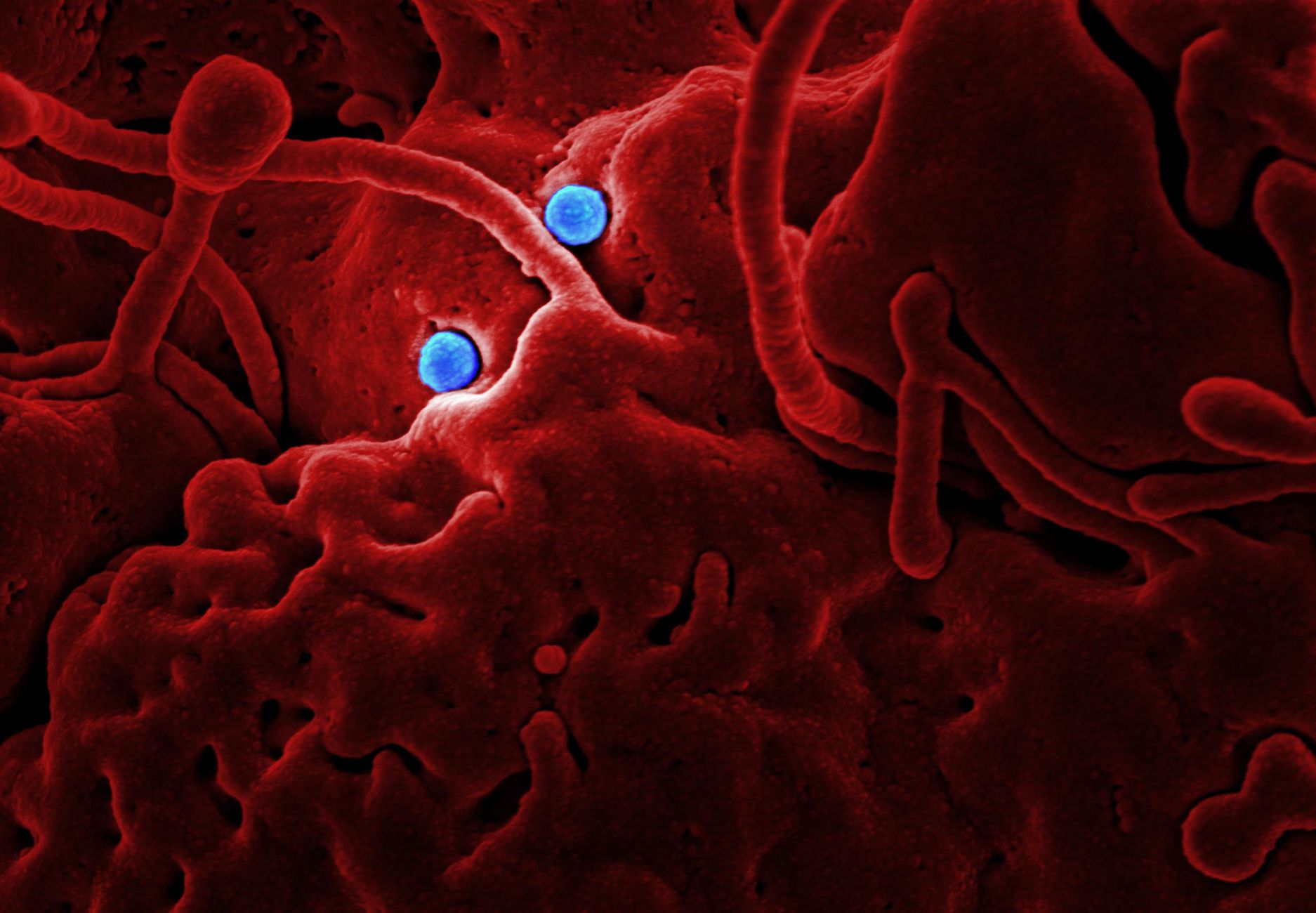 microscopic bacteria spreading through bloodstream