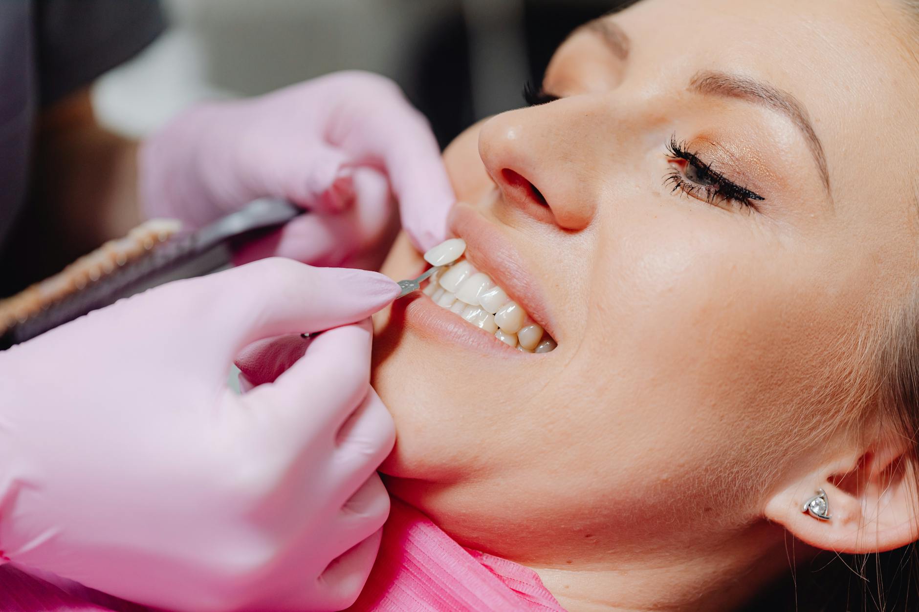 modern cosmetic dentistry procedures teeth whitening veneers